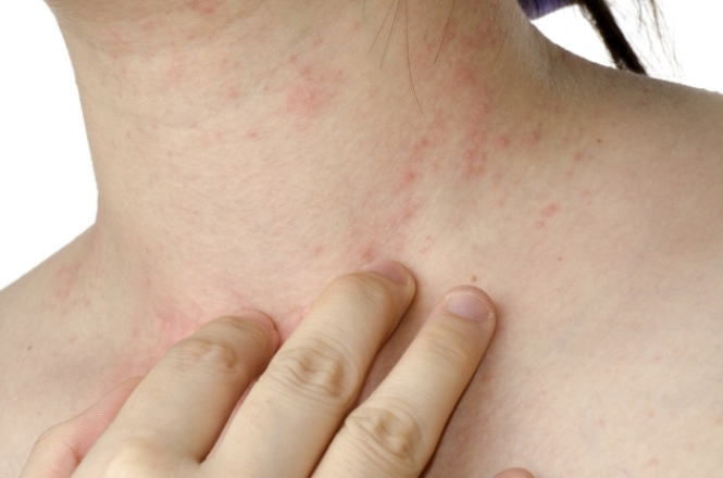 Jornal Bom Dia | Not&iacute;cias | Not&iacute;cias: voce-sabia-que-sua-roupa -pode-ser-a-responsavel-por-aquela-alergia-que-tanto-incomoda-